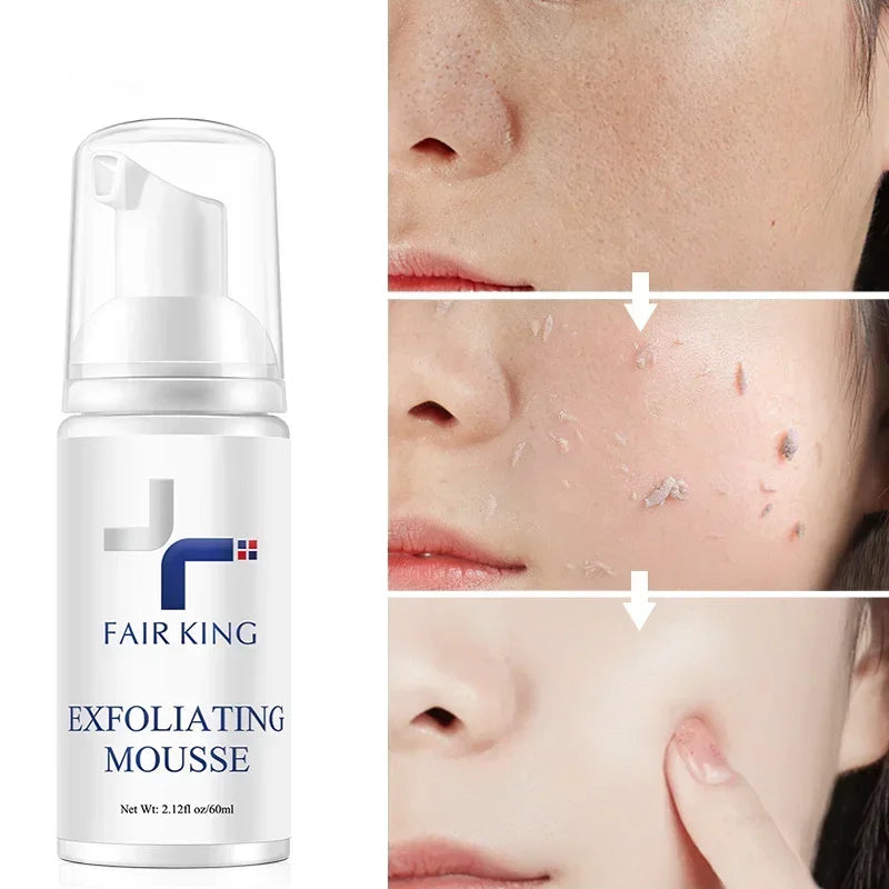 FAIR KING Exfoliating Mousse – Pore Minimizing & Oil Control Cleanser