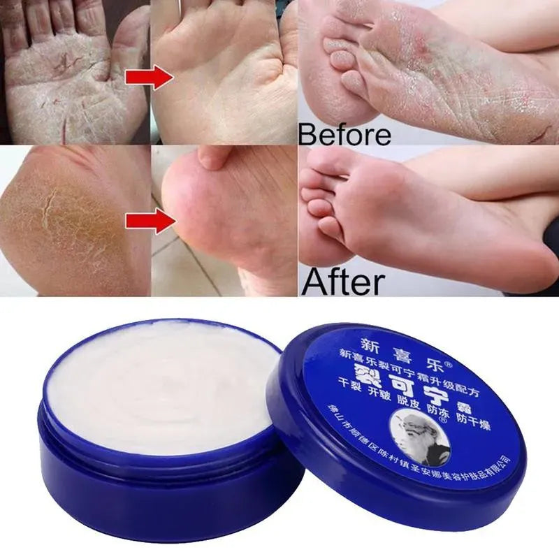 Feet and Hand Crack Removal Cream.