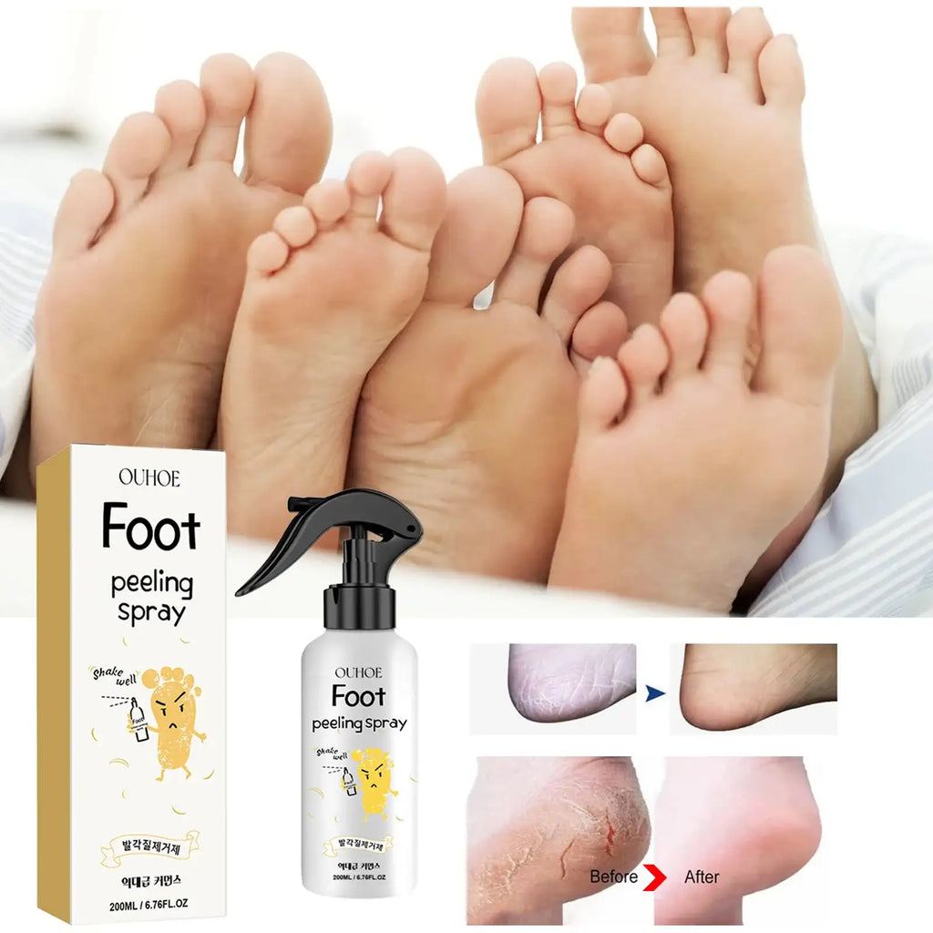 Foot Exfoliating Spray | 72H Moisture Lock Callus Softener
