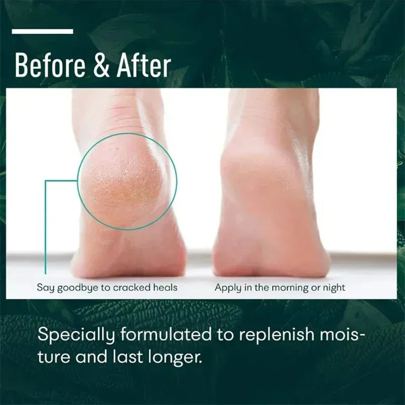 Herbal Anti Crack Foot Heel Cracking Repair Cream.