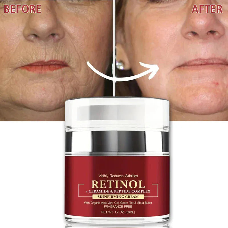 Instant Retinol Cream – Anti-Aging Firming & Lifting