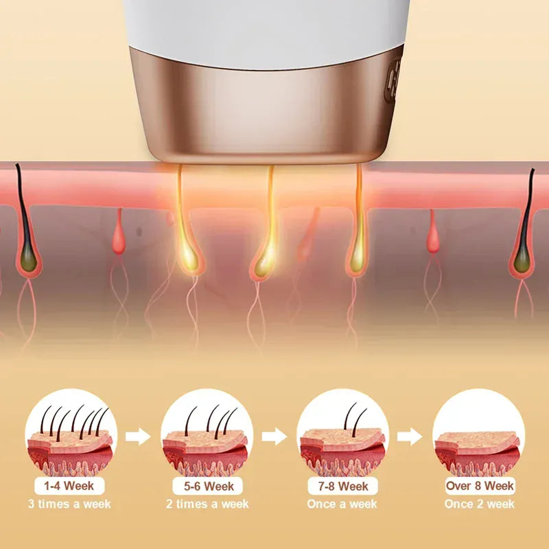 Painless Electric Epilator Laser Hair Removal.