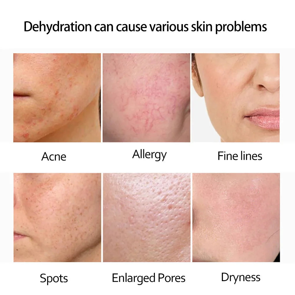 Retinol Anti Wrinkle Dark Spot Removal.